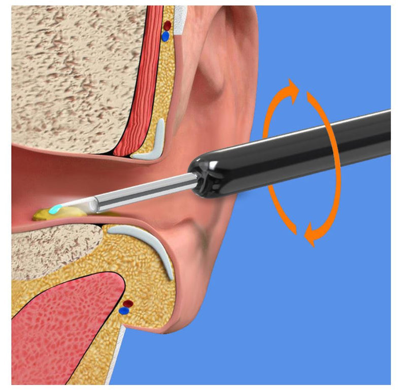 ZAMORA MART earwax removal kit with tools for safe ear cleaning and earwax extraction, shown in a compact kit.