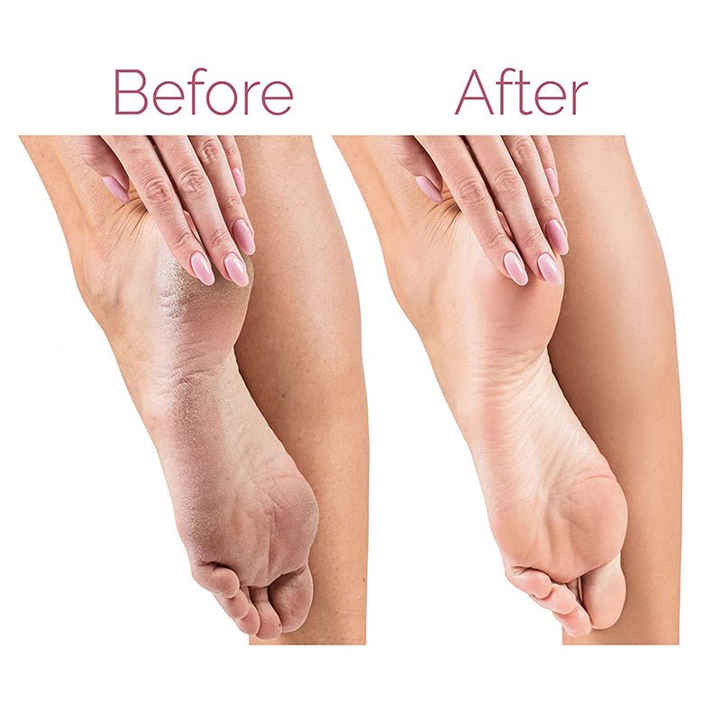 Electric ZAMORA MART foot file callus remover for smoothing and exfoliating dry, rough feet with a compact, ergonomic design.