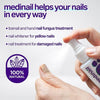 ZAMORA MART Nail Fungus Spray bottle, clear label, white spray cap, designed for treating nail fungus infections.