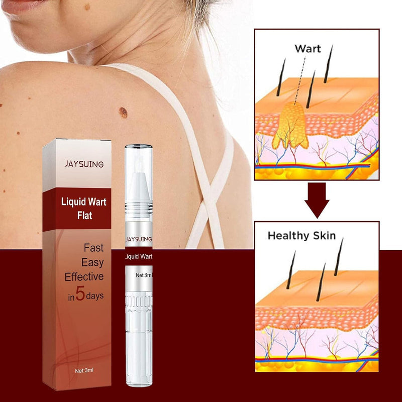 ZAMORA MART Liquid Wart Flat treatment bottle showing clear liquid solution for wart removal.