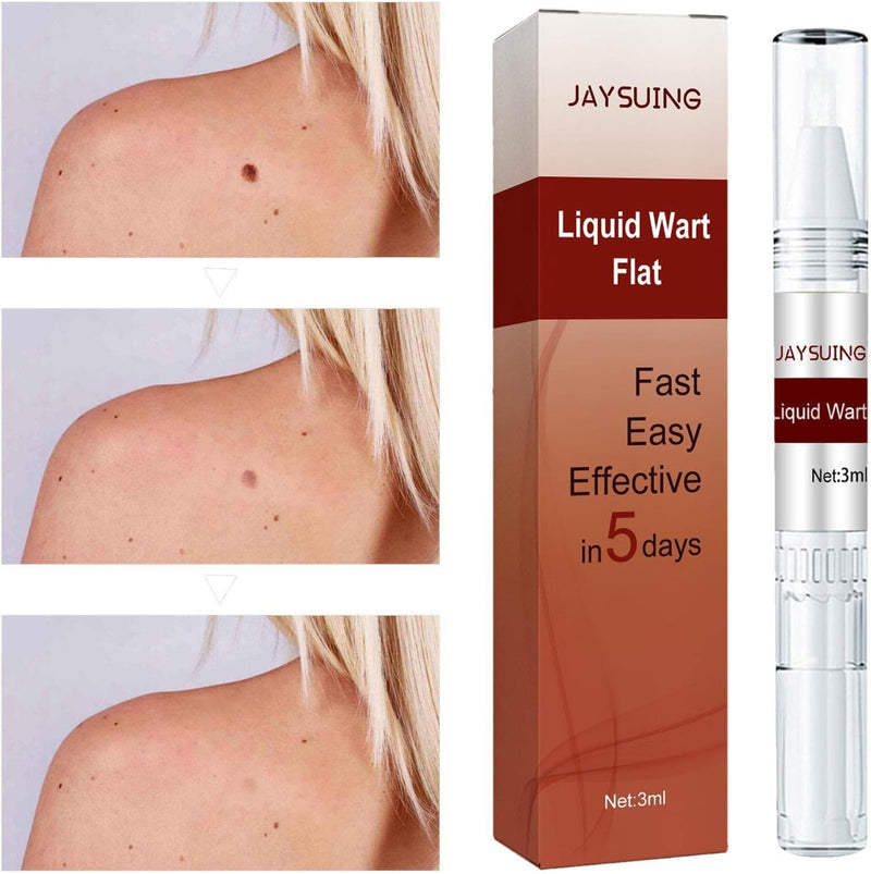 ZAMORA MART liquid wart flat treatment bottle, clear liquid solution for wart removal on skin, shown in a small plastic bottle